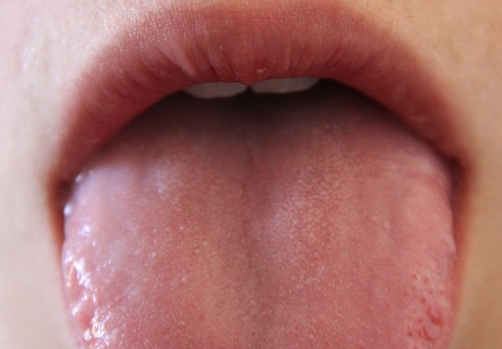 Boca salivando muito: o que pode ser e o que fazer